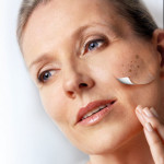 Brown spots and Brightening Brown spots and Brightening